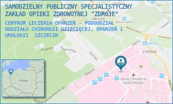 CENTRUM LECZENIA OPARZEŃ - PODODDZIAŁ ODDZIAŁU CHIRURGII DZIECIĘCEJ, OPARZEŃ I UROLOGII - SAMODZIELNY PUBLICZNY SPECJALISTYCZNY ZAKŁAD OPIEKI ZDROWOTNEJ "ZDROJE" W SZCZECINIE - MĄCZNA 4,  SZCZECIN